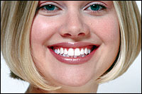 Teeth After Whitening Treatment